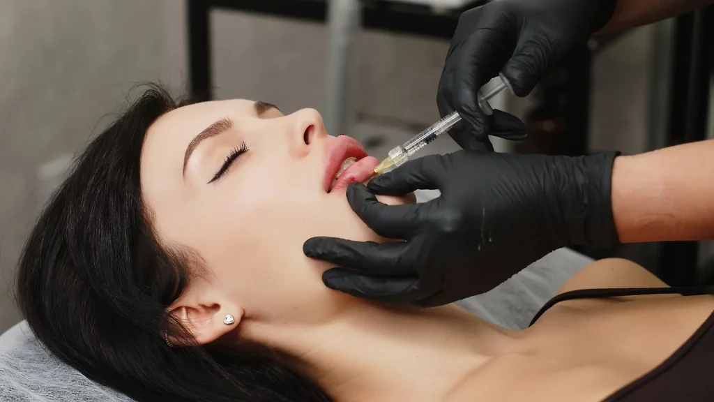 Lip Fillers